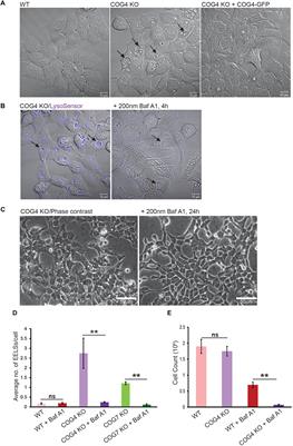 Defects in COG-Mediated Golgi Trafficking Alter Endo-Lysosomal System in Human Cells